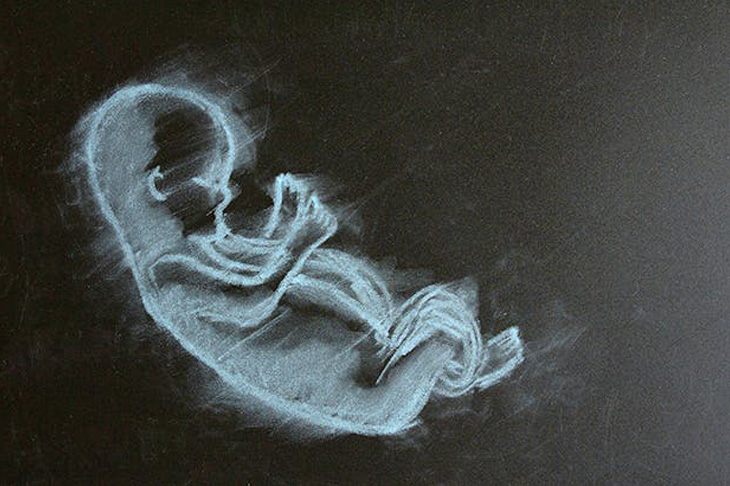 The result of the Irish referendum is a triumph of light over darkness. For others it is the other way round